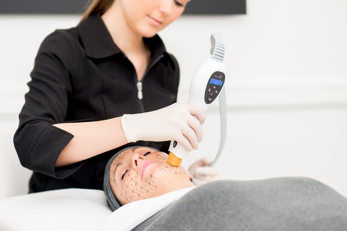 Ультразвуковой лифтинг