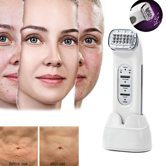 Смарт термаж