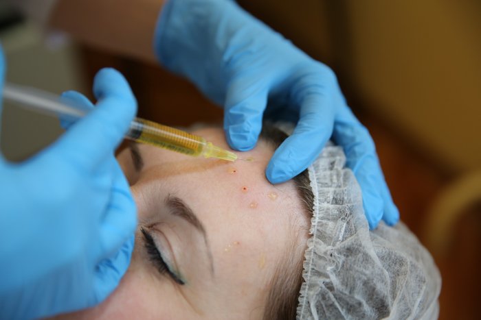 PRP терапия в косметологии