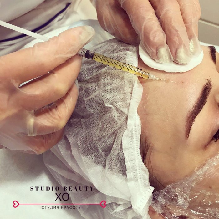 Инъекционная косметология