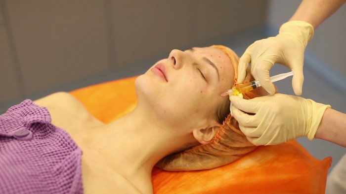 Плазмотерапия косметология