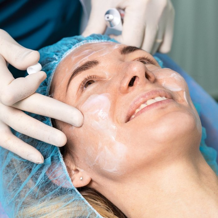 Плазменный лифтинг лица и шеи