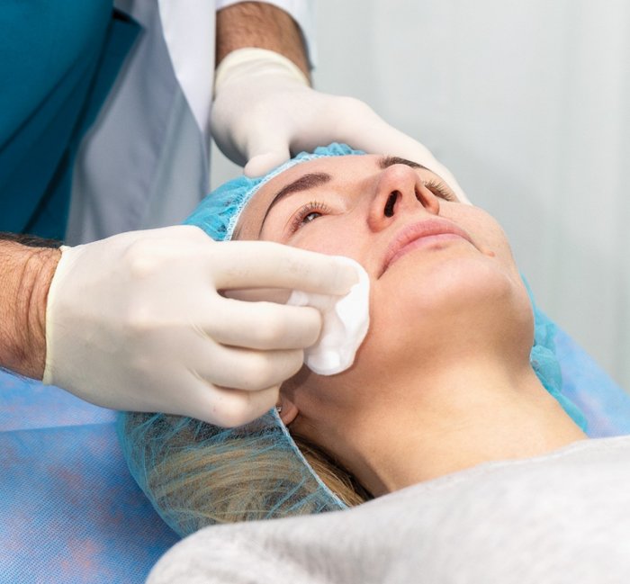 Биоревитализация зоны декольте до и после