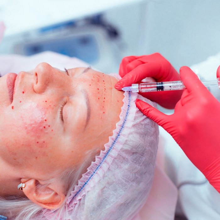 Процедура омоложения Ленина