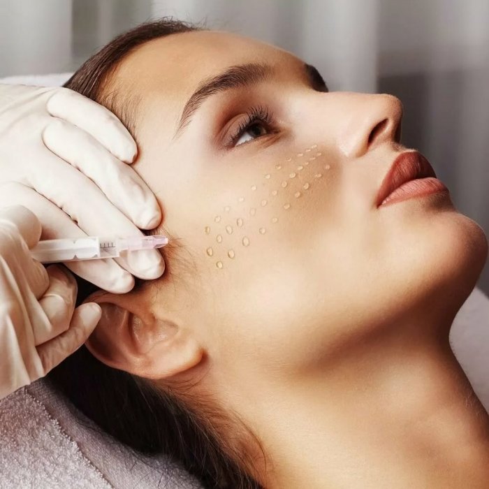 RF лифтинг шеи результат