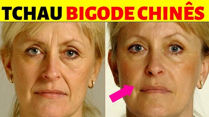 До и после плазмолифтинга лица