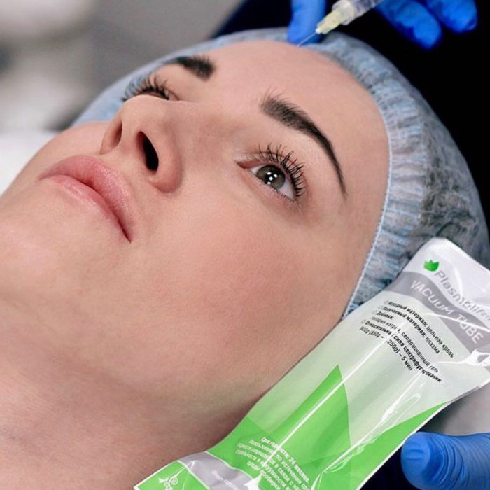 Плазмолифтинг в косметологии