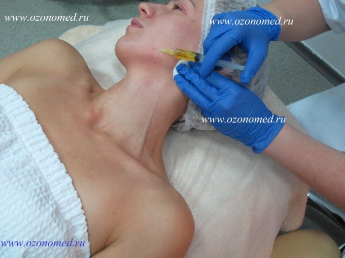 Плазмотерапия косметология