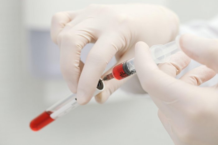 Плазма в косметологии для лица