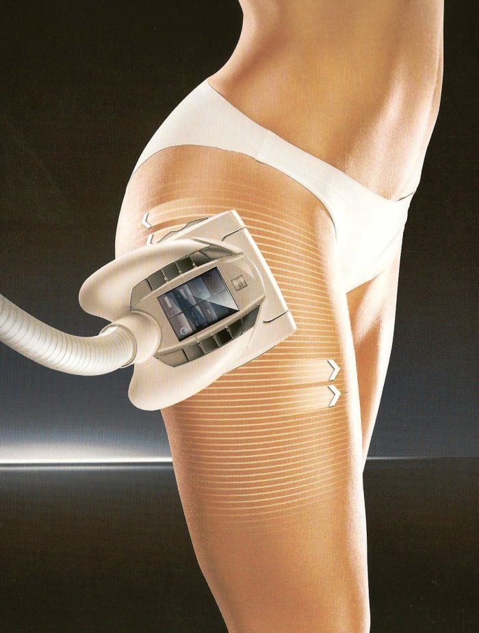 LPG массаж аппарат