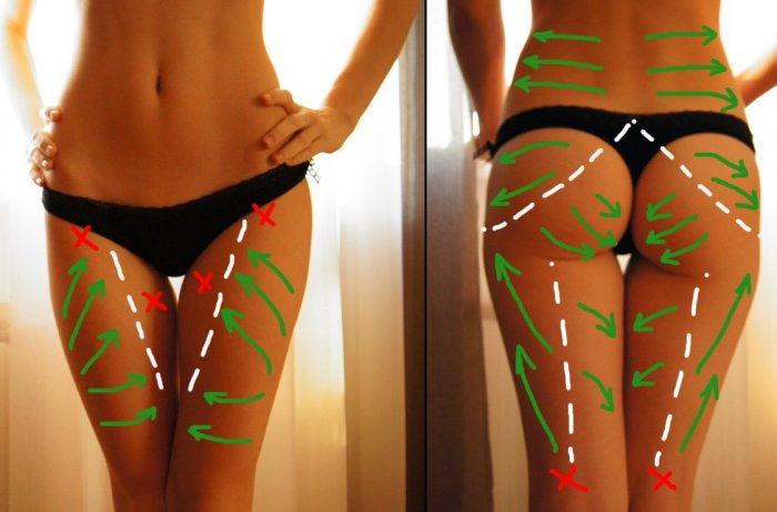 Техника лимфодренажного массажа