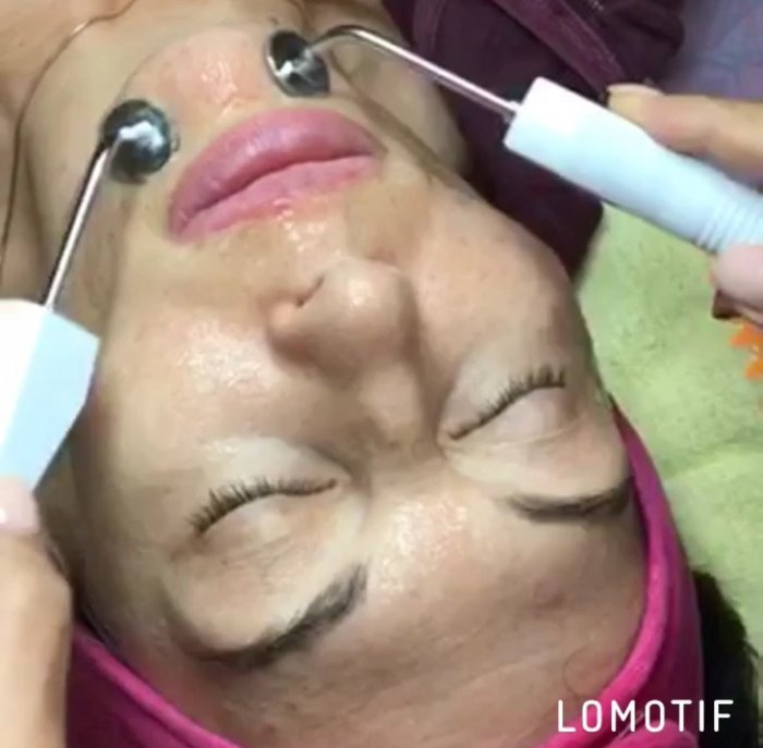 Физиотерапия миостимуляция