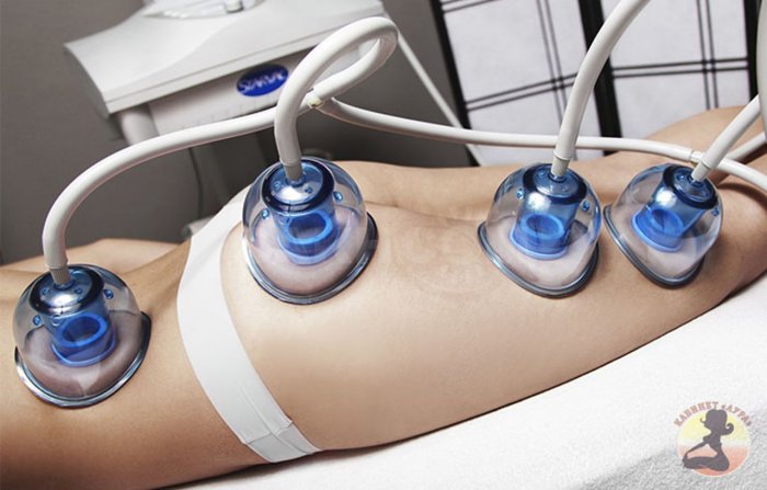 Вакуумный массаж тела