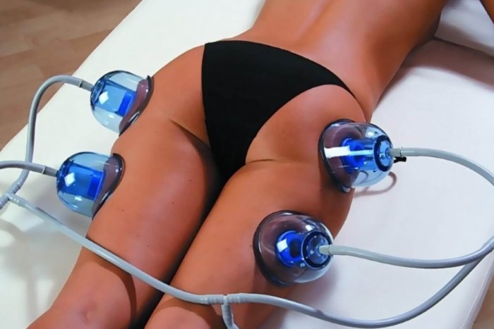 Вакуумный массаж бедер