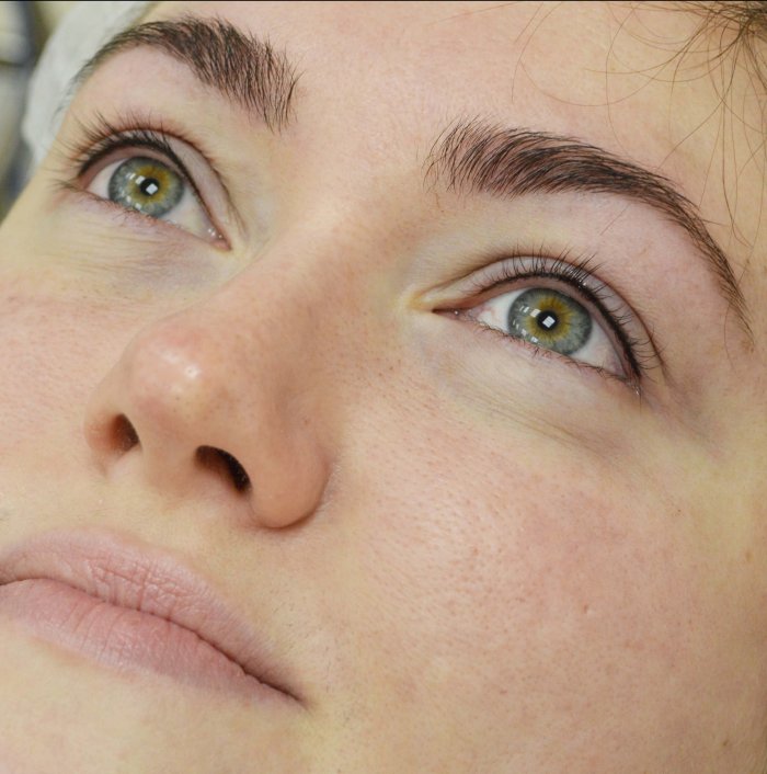Межресничное пространство тёмные глаза