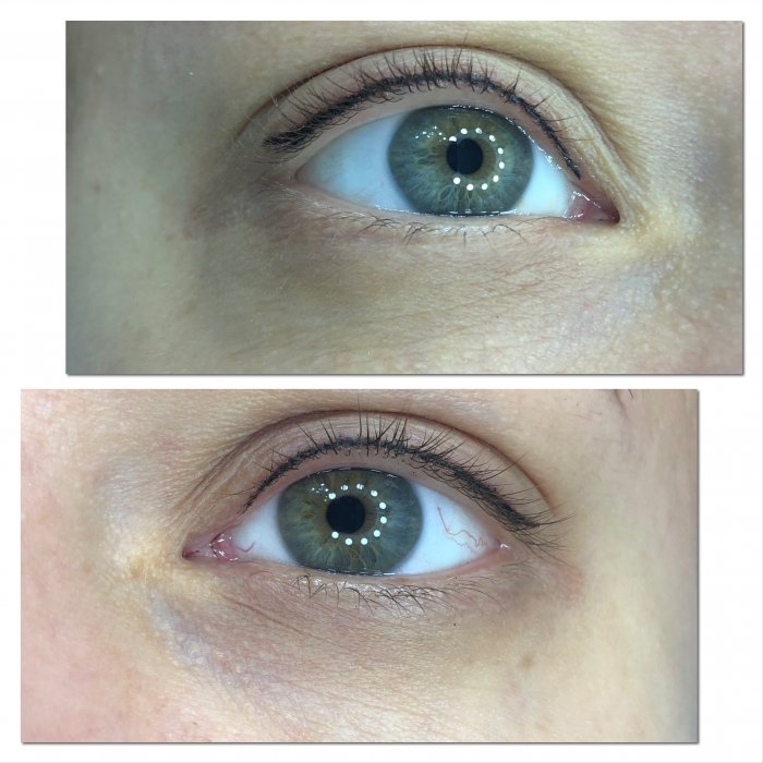 Татуаж межресничка на нависшее веко