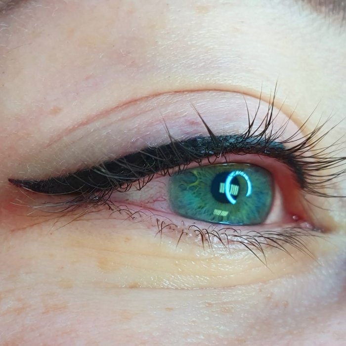 Межресничка коричневый пигмент