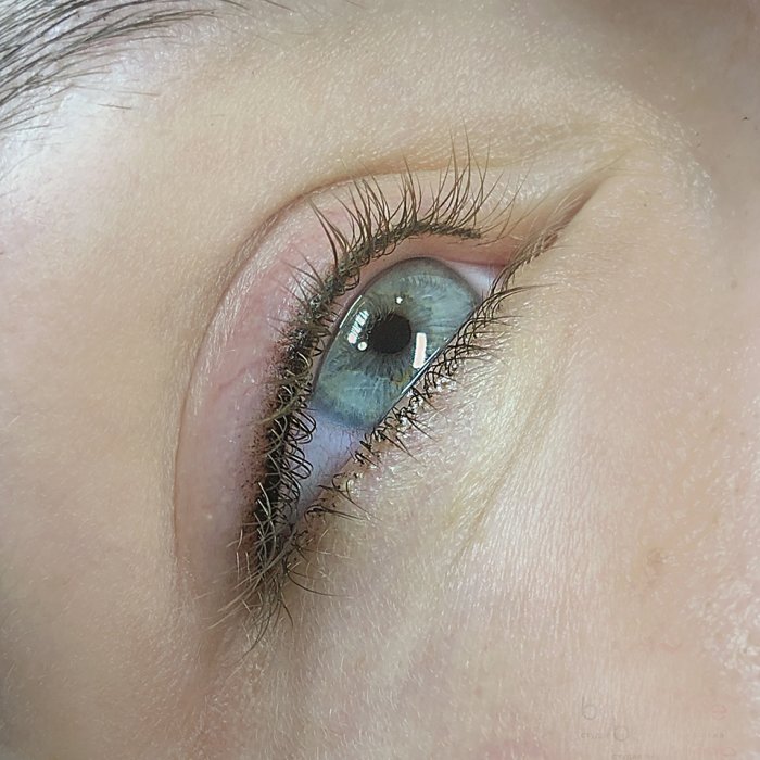 Межресничка с белыми ресницами