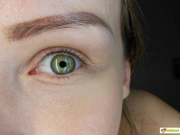 Пудровая межресничка