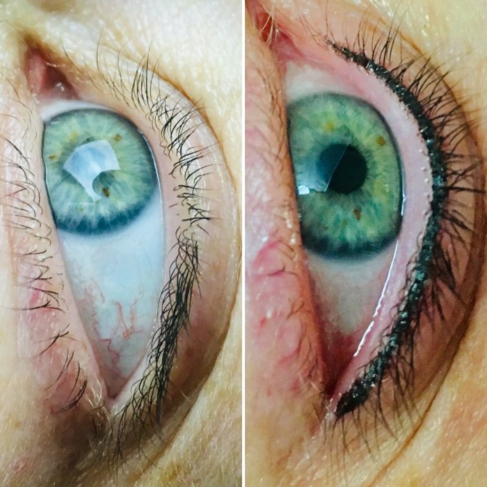 Пигмент спирали в глазах