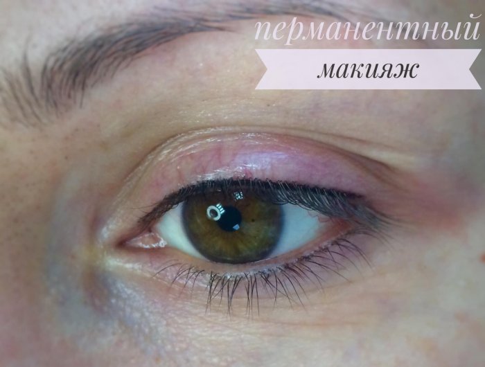 Сразу после татуажа век