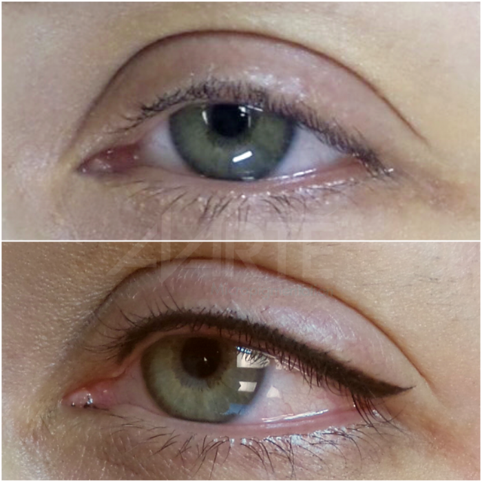 Межресничный татуаж глаз до заживления