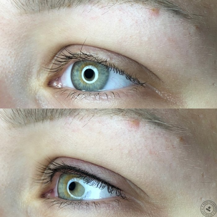 Межресничный татуаж бровей