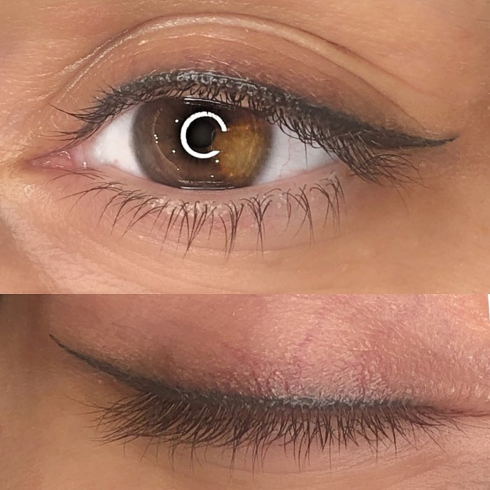 Межресничное пространство и классическая стрелка