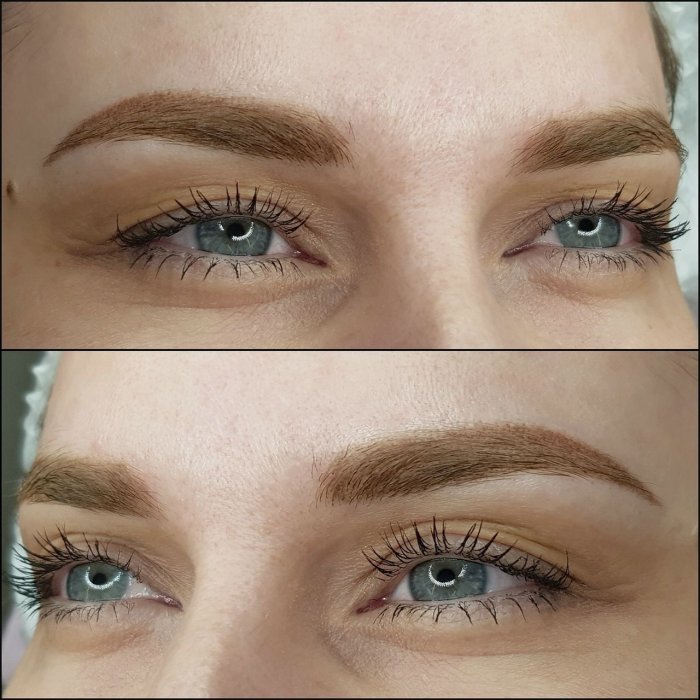 Веснушки 2020