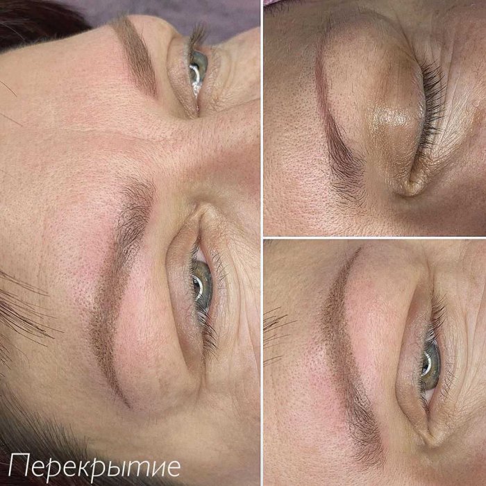 Остатки татуажа бровей