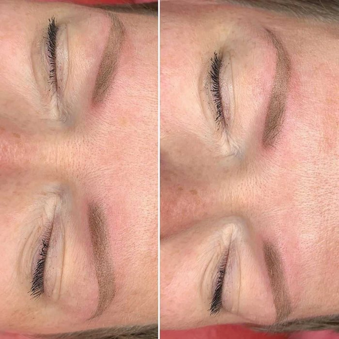 Аллергия на перманентный макияж бровей