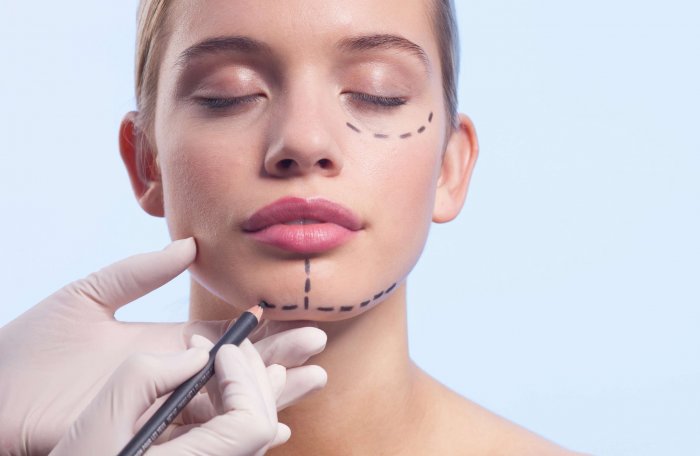 Эстетическая операция это