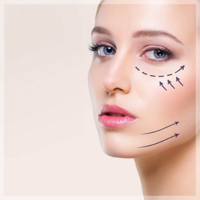 Блефаропластика разметка