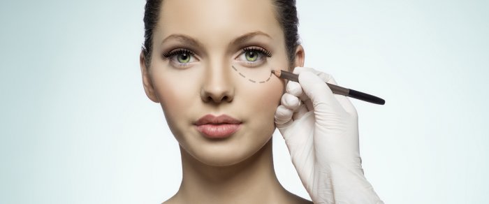 Блефаропластика косметология