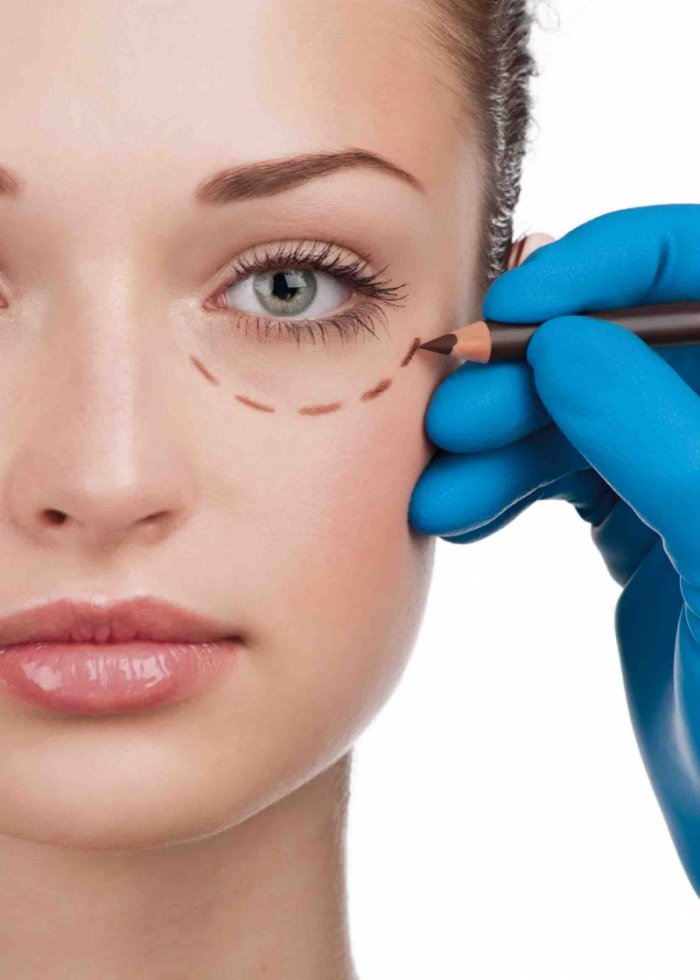 Блефаропластика операция