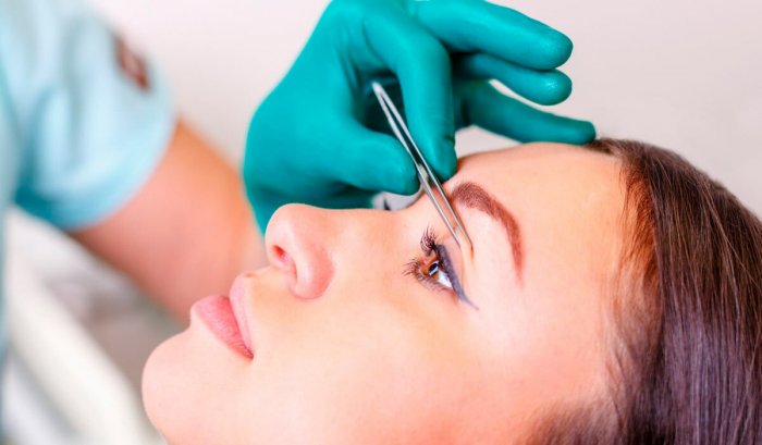 Пластическая операция век