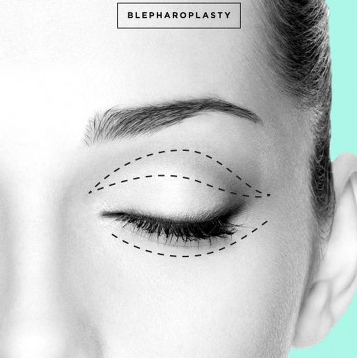 Хирург косметолог