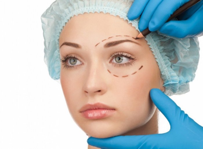 Блефаропластика реклама