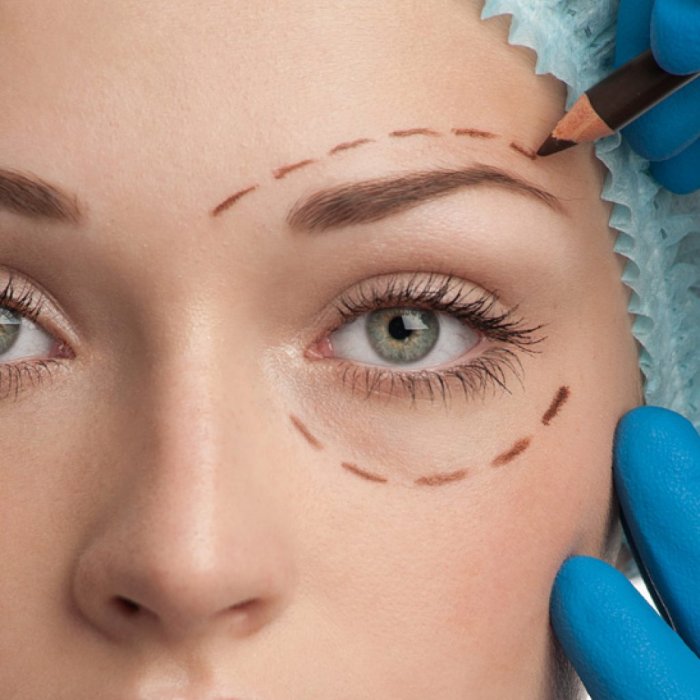 Блефаропластика реклама