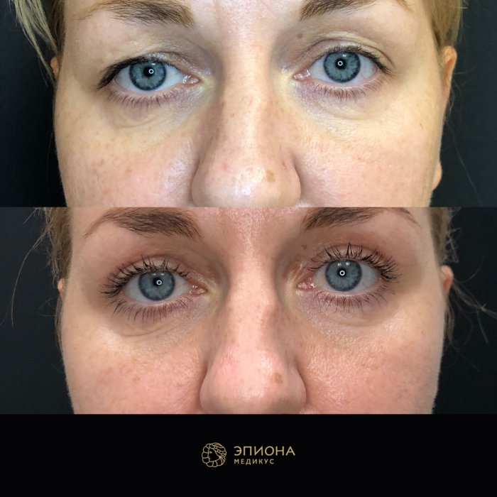 Косметологические операции