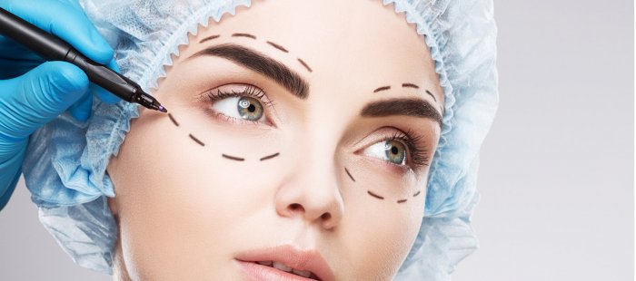 Блефаропластика нависание верхнего века