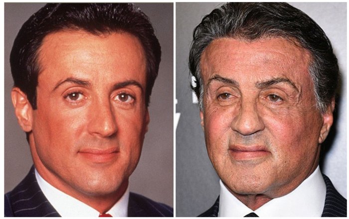 Пластика у мужчин