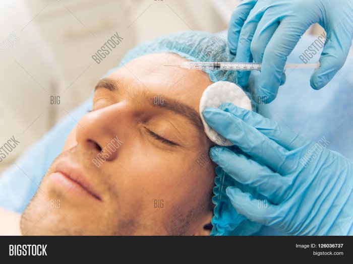 Слаборазвитый подбородок