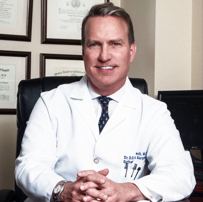 Ринопластика до и после мужчины