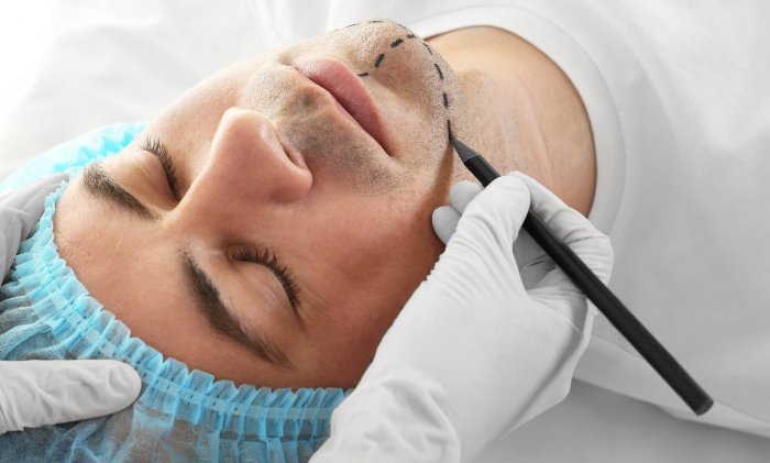 Мужской ботокс