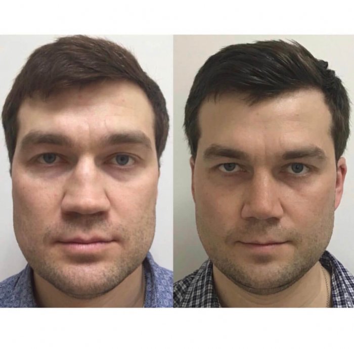 Криштиану Роналду до пластики