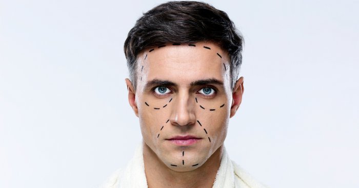 Мужская пластическая хирургия лица