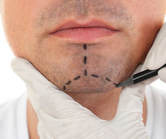 Пластическая хирургия для мужчин