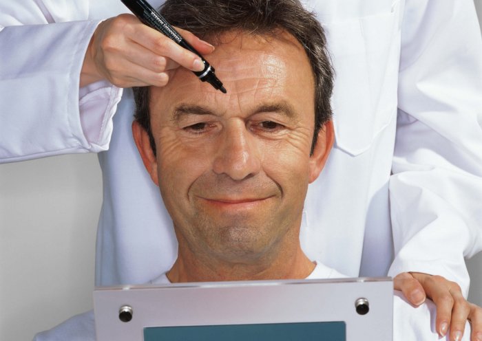 Мужская пластическая хирургия лица