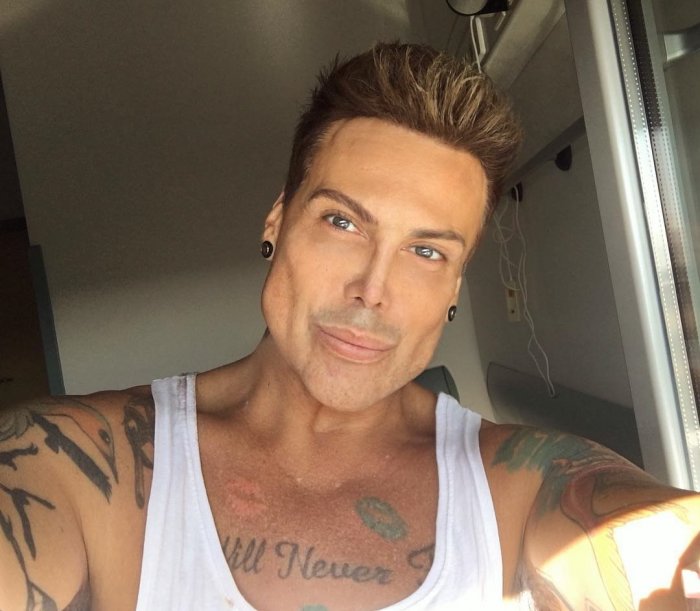 Сильвестр Сталлоне до и после пластики